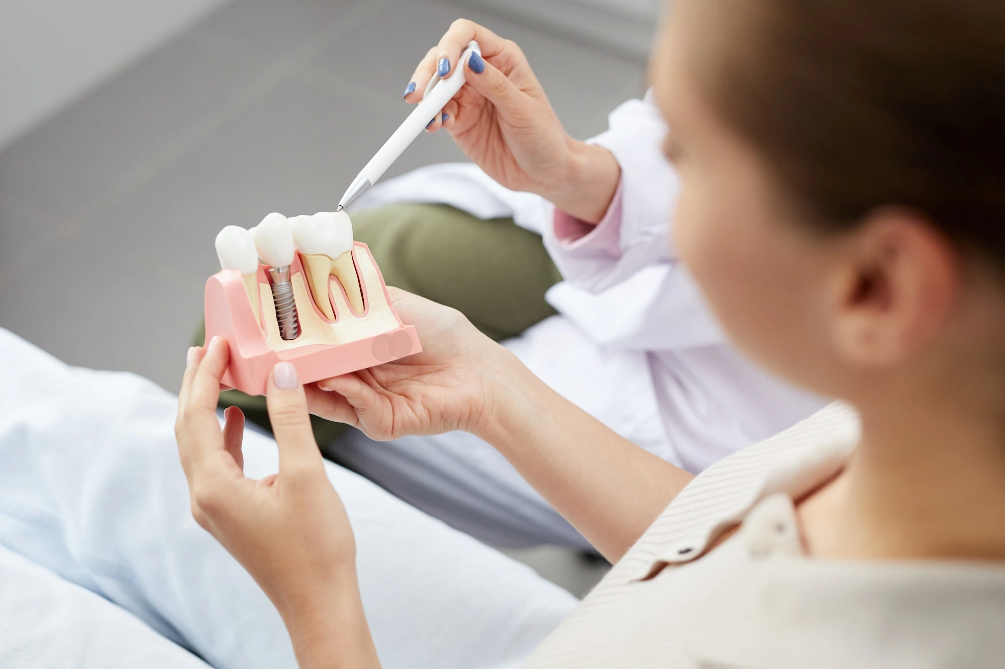 best dental implants