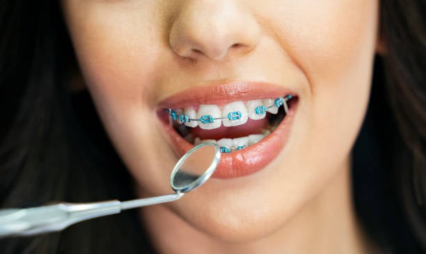 affordable orthodontics