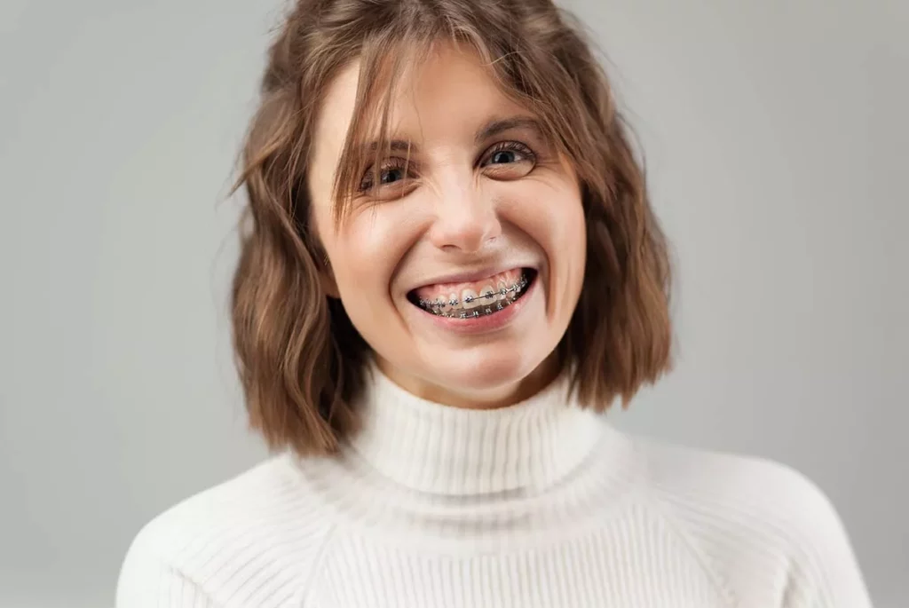 ¿Cuánto cuestan los brackets en Latinoamérica este 2025?