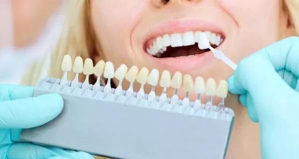 ¿Qué tratamientos dentales son los más buscados en el extranjero?
