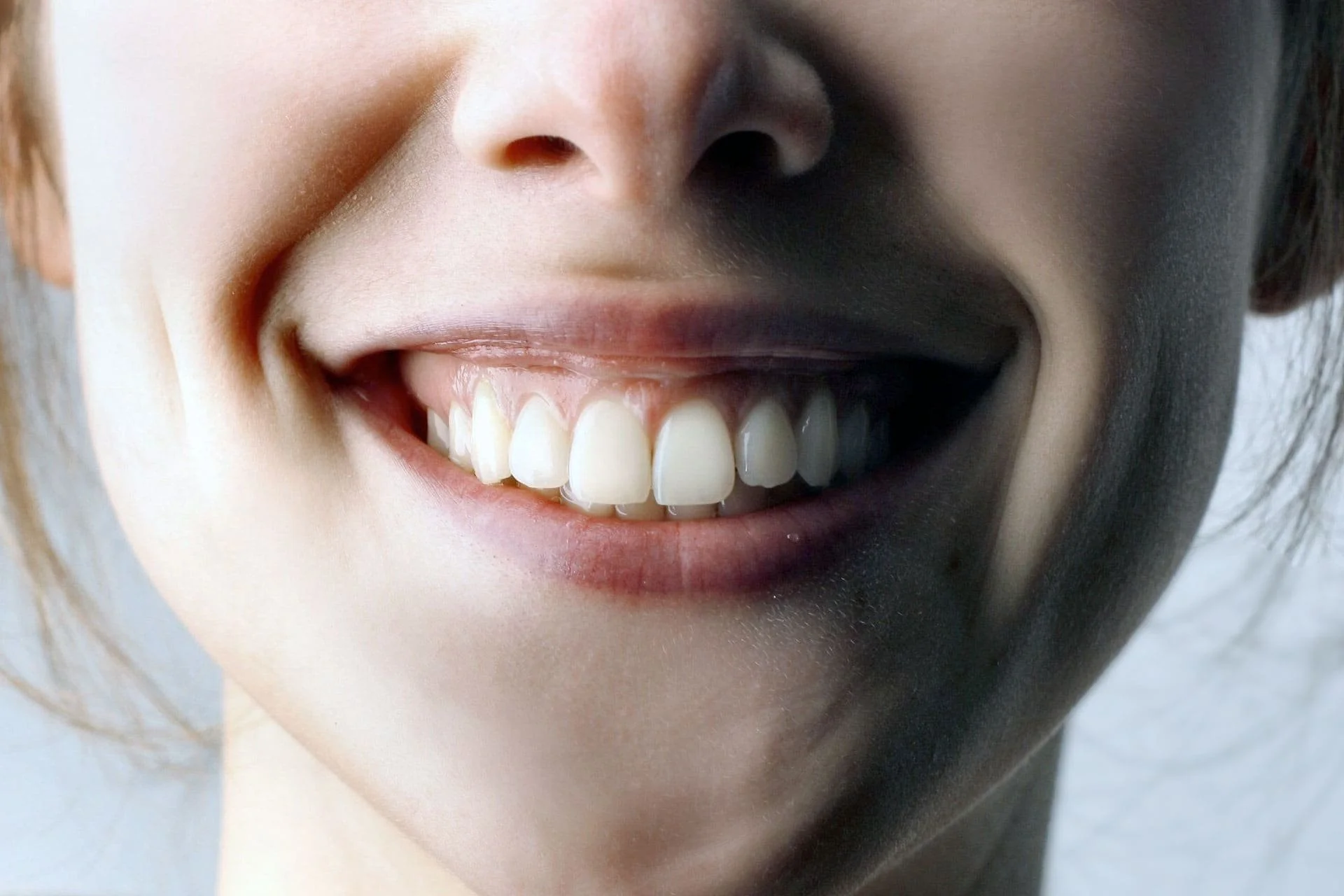 Pinhole Gum Graft | Técnica Pinhole