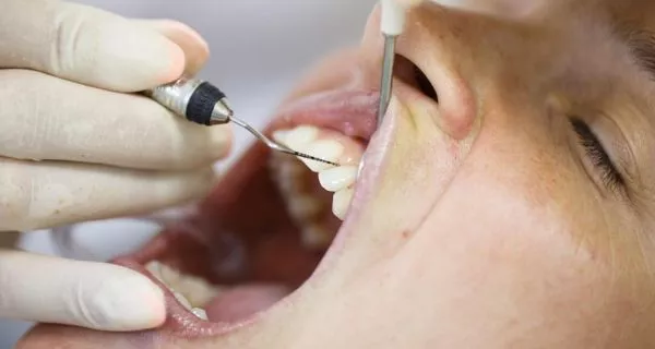 How is the pinhole gum graft different from traditional surgery?