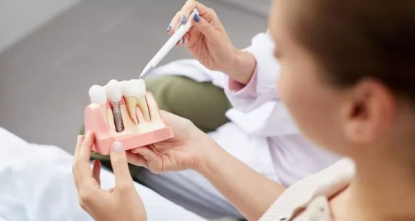 What is the cost of dental implants and why does it matter?