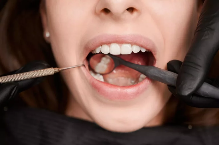 What Are The Benefits of Getting Your Teeth Fixed in Colombia with Find Dentist?