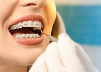 How much are orthodontic braces if done in Latin America?