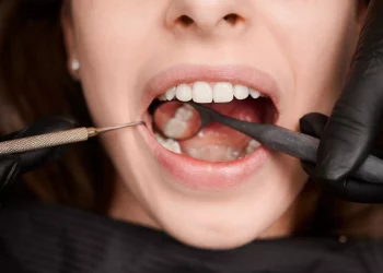 What Are The Benefits of Getting Your Teeth Fixed in Colombia with Find Dentist?